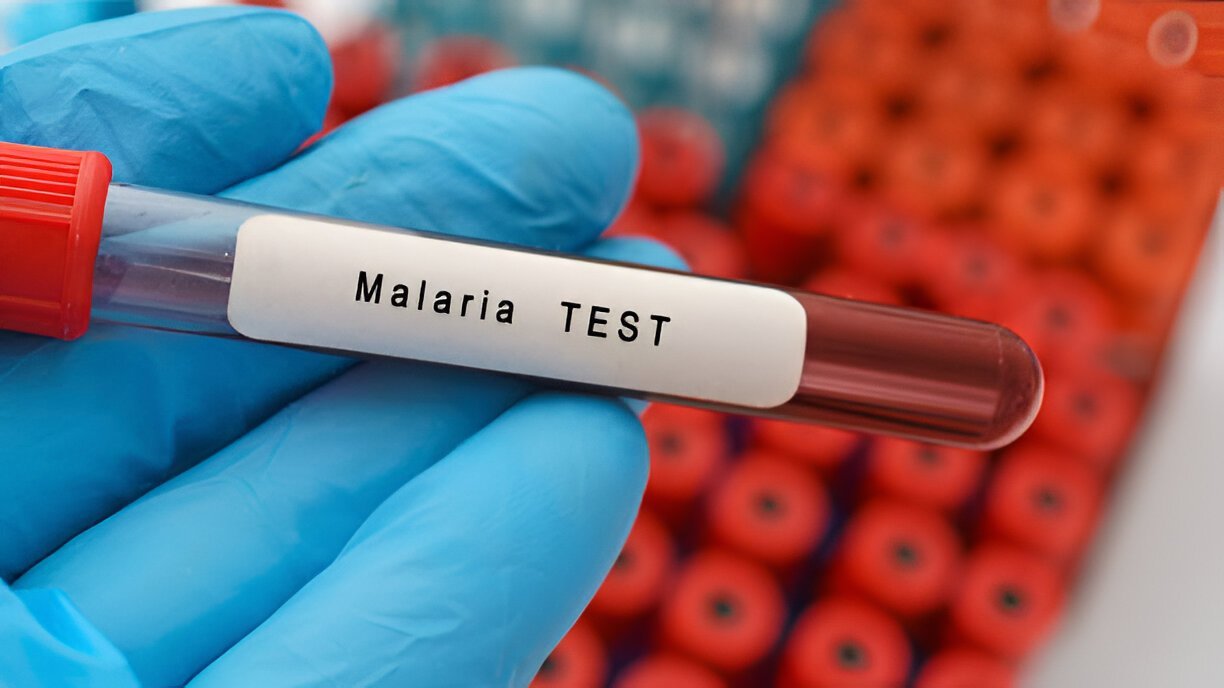 Anti-Malarial Drug Portfolio – Taj Life Sciences